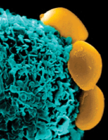 Image: Camouflaged nanoparticles (yellow) cloaked in the membranes of white blood cells rest on the surface of an immune system cell (phagocyte, blue) without being recognized, ingested, and destroyed (Photo courtesy of Ennio Tasciotti lab, Methodist Hospital Research Institute).